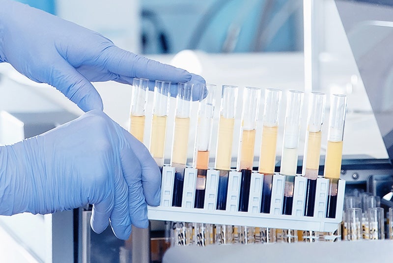 gloved hands and vials