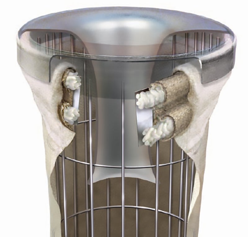 filter bag dissection illustration
